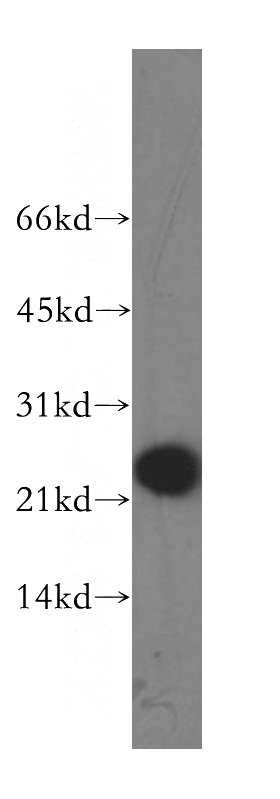 human liver tissue were subjected to SDS PAGE followed by western blot with Catalog No:111151(GPX7 antibody) at dilution of 1:1000