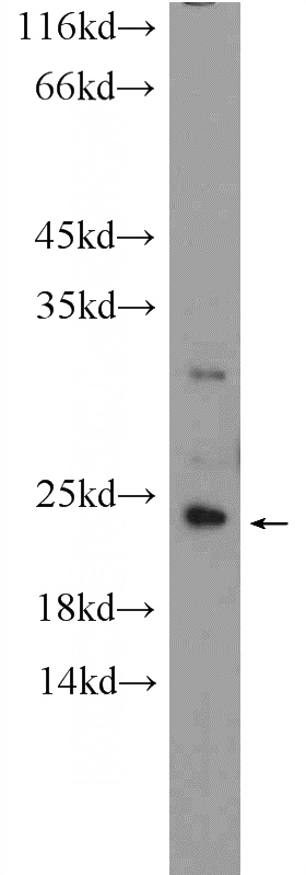 mouse liver tissue were subjected to SDS PAGE followed by western blot with Catalog No:108723(C3orf34 Antibody) at dilution of 1:300