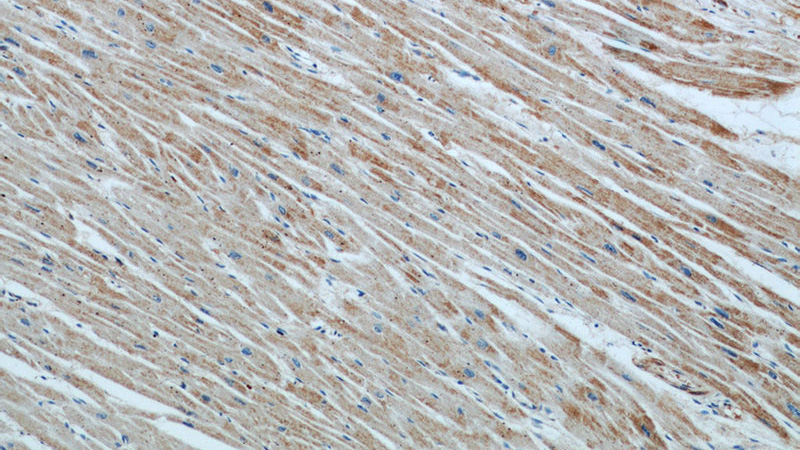 Immunohistochemical of paraffin-embedded human heart using Catalog No:108128(APAF1 antibody) at dilution of 1:50 (under 10x lens)