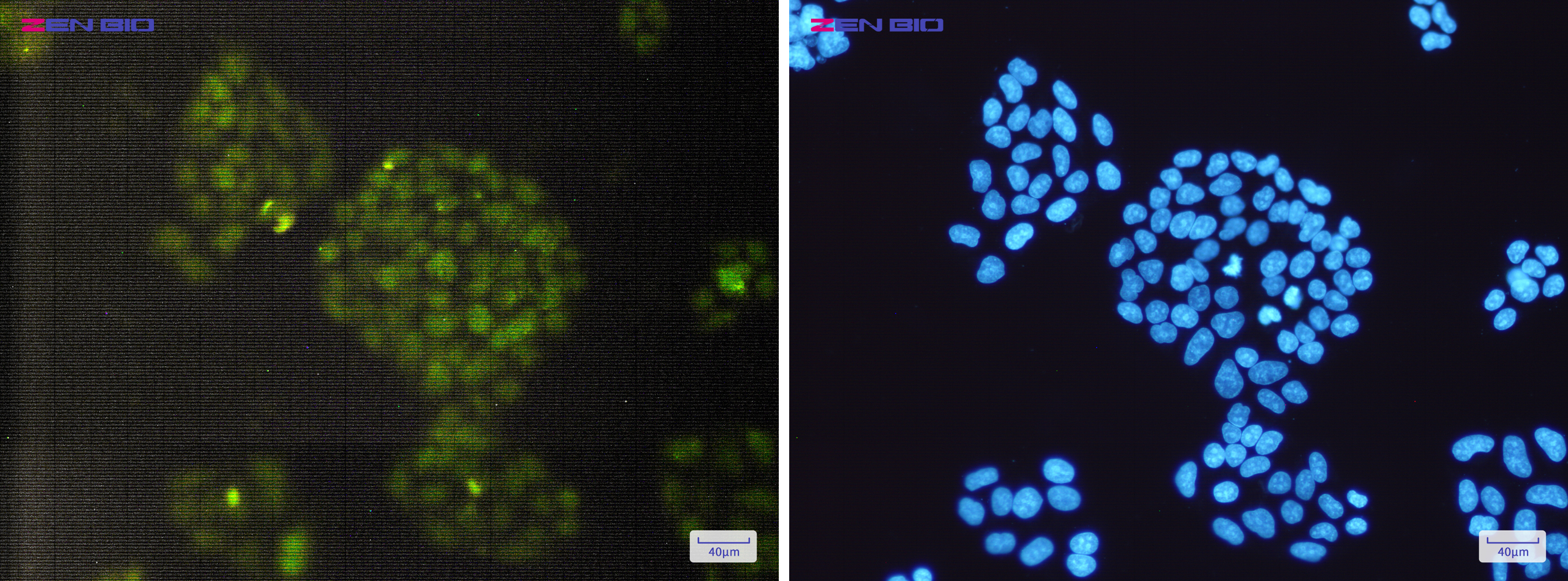 Immunocytochemistry of ERCC1(green) in Hela cells using ERCC1 Rabbit mAb at dilution 1/200, and DAPI(blue)