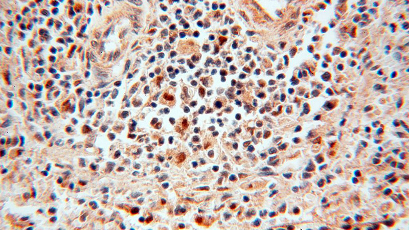 Immunohistochemical of paraffin-embedded human spleen using Catalog No:114033(POLM antibody) at dilution of 1:50 (under 40x lens)