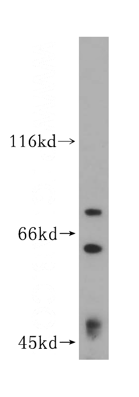 HepG2 cells were subjected to SDS PAGE followed by western blot with Catalog No:111511(HNRNPR antibody) at dilution of 1:300