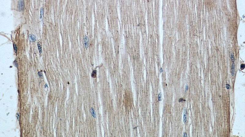Immunohistochemistry of paraffin-embedded human skeletal muscle slide using Catalog No:107373(LC3A/B Antibody) at dilution of 1:50