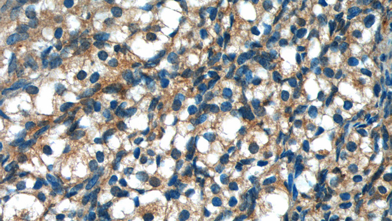 Immunohistochemistry of paraffin-embedded human ovary tissue slide using Catalog No:116674(UCHL5IP Antibody) at dilution of 1:50 (under 40x lens)