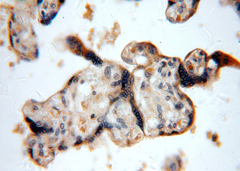 Immunohistochemical of paraffin-embedded human placenta using Catalog No:116285(TNFAIP1 antibody) at dilution of 1:50 (under 40x lens)