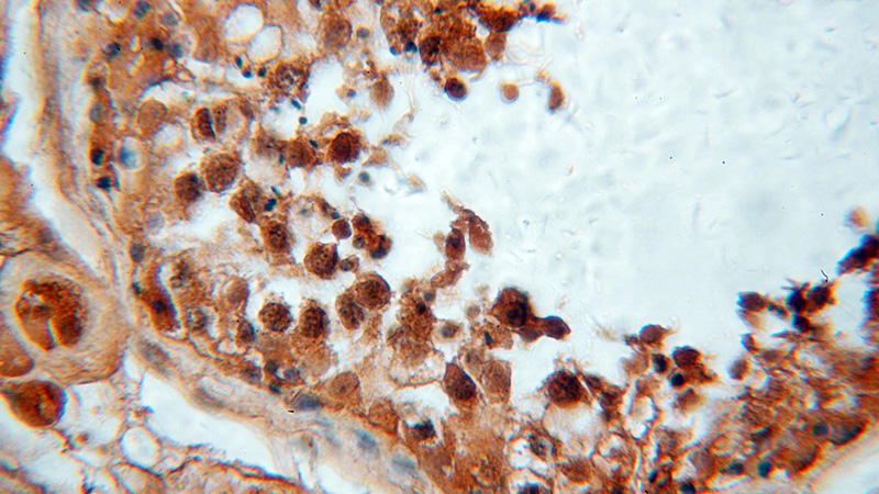 Immunohistochemical of paraffin-embedded human testis using Catalog No:115619(SSX4 antibody) at dilution of 1:50 (under 40x lens)