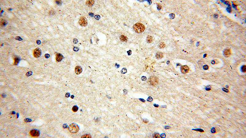Immunohistochemical of paraffin-embedded human brain using Catalog No:113607(PAX6 antibody) at dilution of 1:50 (under 40x lens)