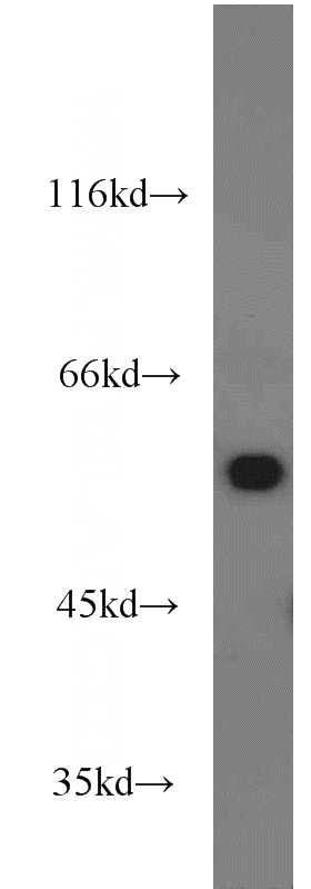 mouse liver tissue were subjected to SDS PAGE followed by western blot with Catalog No:112574(ME1 antibody) at dilution of 1:2000