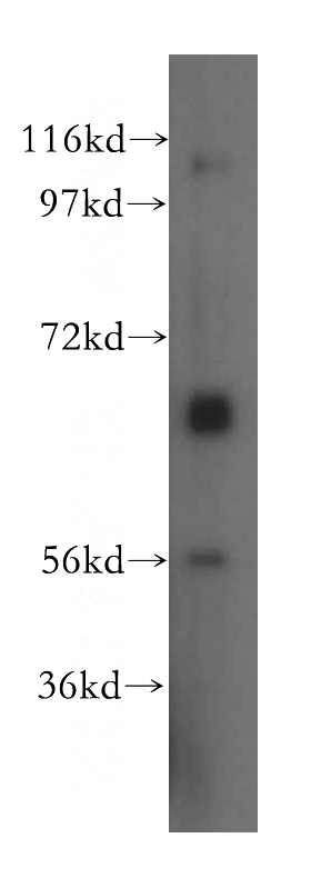 human liver tissue were subjected to SDS PAGE followed by western blot with Catalog No:115348(SLC7A4 antibody) at dilution of 1:500
