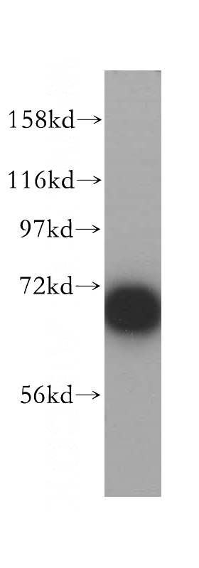 HeLa cells were subjected to SDS PAGE followed by western blot with Catalog No:113560(p70(S6K) antibody) at dilution of 1:1200
