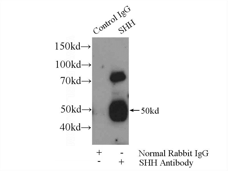 IP Result of anti-SHH (IP:Catalog No:115273, 4ug; Detection:Catalog No:115273 1:500) with mouse liver tissue lysate 6400ug.