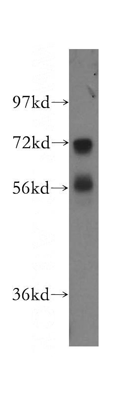 human liver tissue were subjected to SDS PAGE followed by western blot with Catalog No:113278(NRG1 antibody) at dilution of 1:250