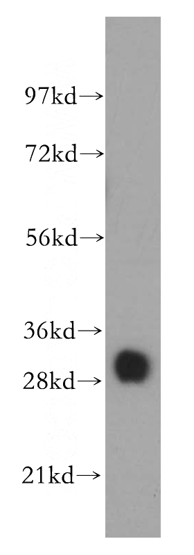mouse heart tissue were subjected to SDS PAGE followed by western blot with Catalog No:116207(TPM4 antibody) at dilution of 1:100