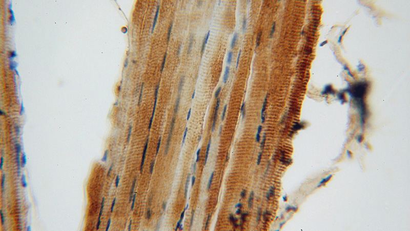Immunohistochemical of paraffin-embedded human skeletal muscle using Catalog No:115339(SLC25A6-Specific antibody) at dilution of 1:100 (under 40x lens)