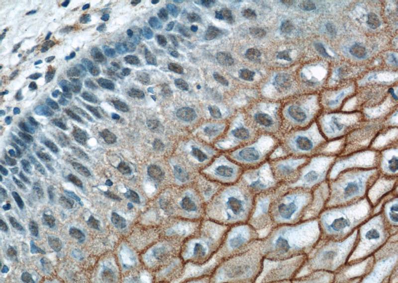 Immunohistochemical of paraffin-embedded human cervix using Catalog No:116028(TGM1 antibody) at dilution of 1:200 (under 40x lens)