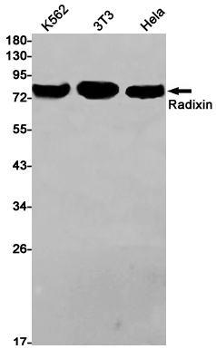 Western blot detection of Radixin in K562,3T3,Hela cell lysates using Radixin Rabbit pAb(1:1000 diluted).Predicted band size:69kDa.Observed band size:80kDa.