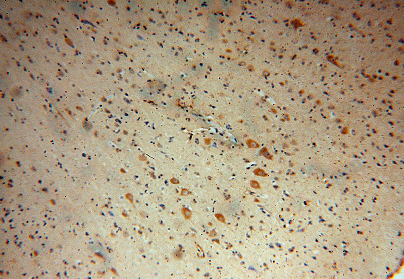 Immunohistochemical of paraffin-embedded human brain using Catalog No:113072(NDUFB2 antibody) at dilution of 1:100 (under 10x lens)