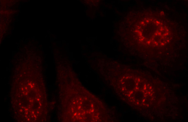Immunofluorescent analysis of HepG2 cells, using C14orf166 antibody Catalog No:108661 at 1:50 dilution and Rhodamine-labeled goat anti-rabbit IgG (red).