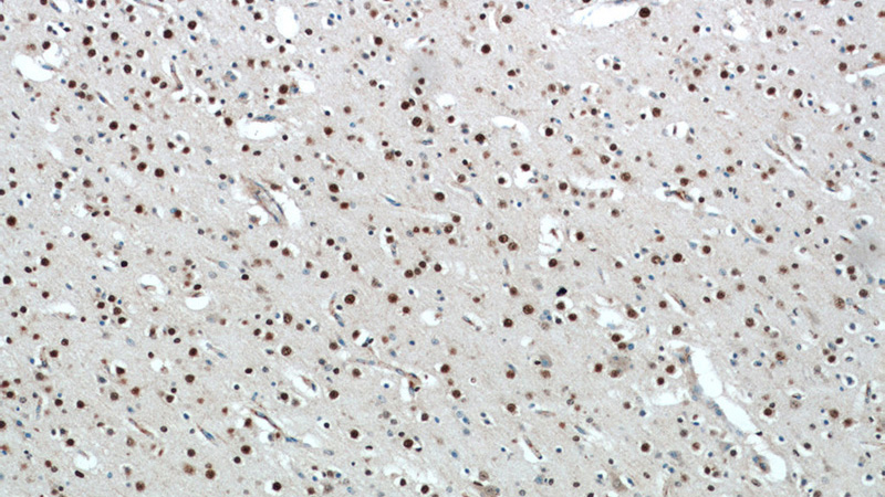 Immunohistochemical of paraffin-embedded human brain using Catalog No:115881(TBR1 antibody) at dilution of 1:100 (under 10x lens)