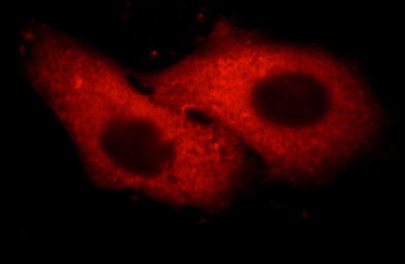 Immunofluorescent analysis of HepG2 cells, using ORM1 antibody Catalog No: at 1:25 dilution and Rhodamine-labeled goat anti-mouse IgG (red).