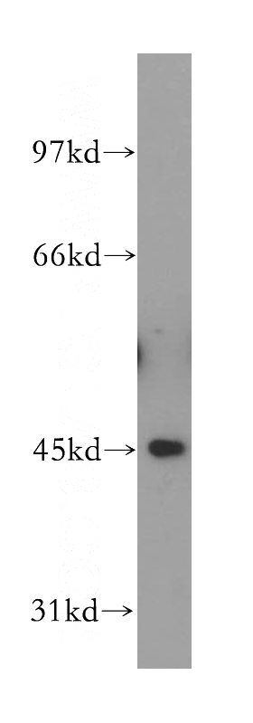 HeLa cells were subjected to SDS PAGE followed by western blot with Catalog No:110550(FBXO22 antibody) at dilution of 1:500