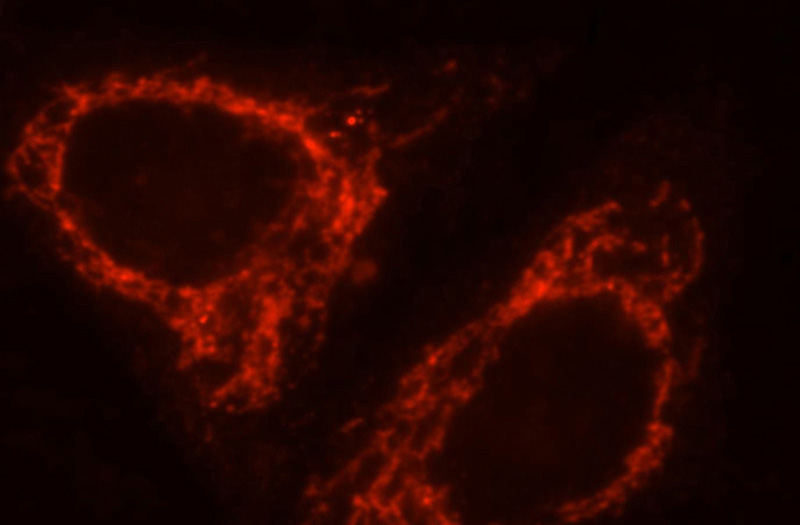 Immunofluorescent analysis of HepG2 cells, using LAMP2 antibody Catalog No:112277 at 1:25 dilution and Rhodamine-labeled goat anti-rabbit IgG (red).