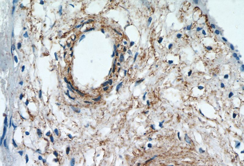 Immunohistochemistry of paraffin-embedded human placenta tissue slide using Catalog No:111927(KCNC4 Antibody) at dilution of 1:50 (under 40x lens)
