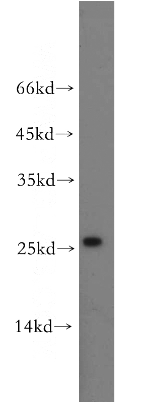 HeLa cells were subjected to SDS PAGE followed by western blot with Catalog No:108969(CCDC25 antibody) at dilution of 1:500