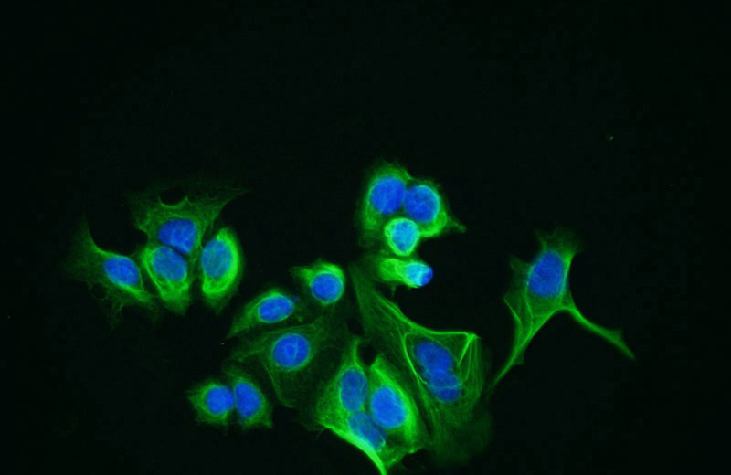 Immunofluorescent analysis of MCF-7 cells using Catalog No:112314(LRCH1 Antibody) at dilution of 1:25 and Alexa Fluor 488-congugated AffiniPure Goat Anti-Rabbit IgG(H+L)
