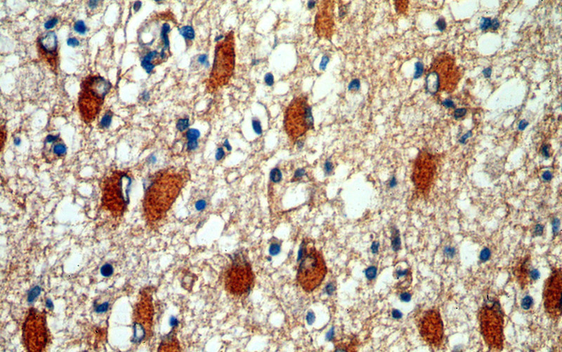 Immunohistochemical of paraffin-embedded human brain using Catalog No:116834(WNT2 antibody) at dilution of 1:100 (under 40x lens)