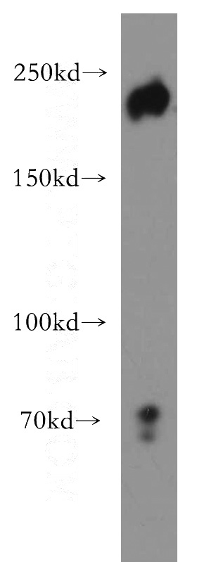 MCF7 cells were subjected to SDS PAGE followed by western blot with Catalog No:117037(ZEB1 antibody) at dilution of 1:500