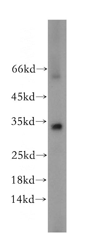mouse liver tissue were subjected to SDS PAGE followed by western blot with Catalog No:111483(HMGCL antibody) at dilution of 1:300