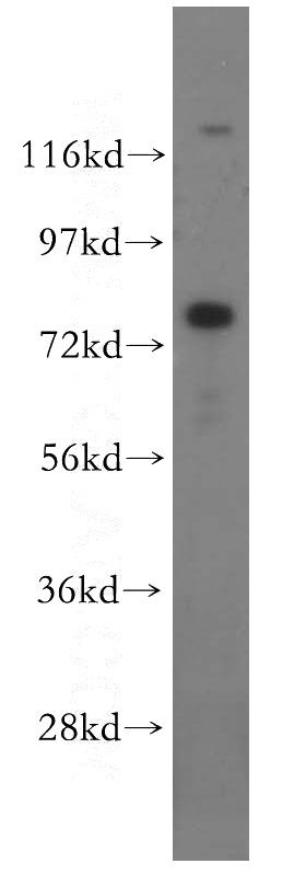 HepG2 cells were subjected to SDS PAGE followed by western blot with Catalog No:112902(MUT antibody) at dilution of 1:500