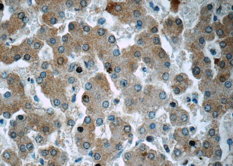Immunohistochemistry of paraffin-embedded human liver tissue slide using Catalog No:113940(Angiostatin Antibody) at dilution of 1:50 (under 40x lens)