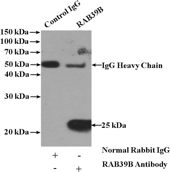 IP Result of anti-RAB39B (IP:Catalog No:114438, 4ug; Detection:Catalog No:114438 1:300) with mouse brain tissue lysate 4000ug.
