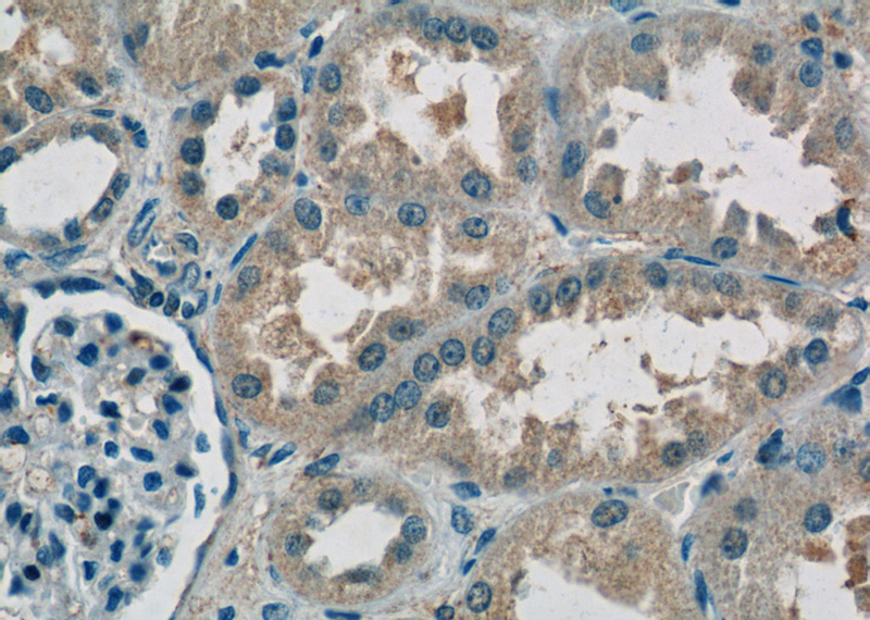 Immunohistochemistry of paraffin-embedded human kidney tissue slide using Catalog No:114837(RPS26 Antibody) at dilution of 1:50 (under 40x lens)