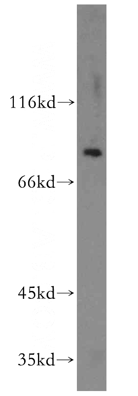 human testis tissue were subjected to SDS PAGE followed by western blot with Catalog No:115627(ST5 antibody) at dilution of 1:500