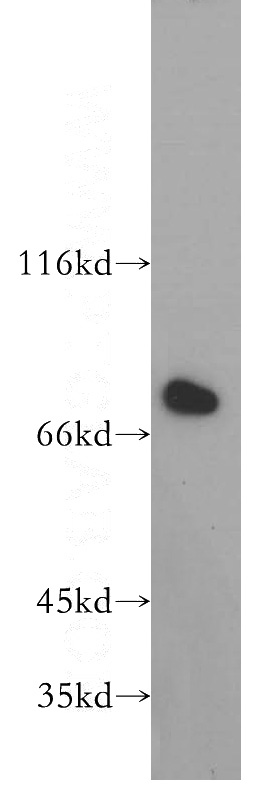 HEK-293 cells were subjected to SDS PAGE followed by western blot with Catalog No:111255(USH1C antibody) at dilution of 1:300
