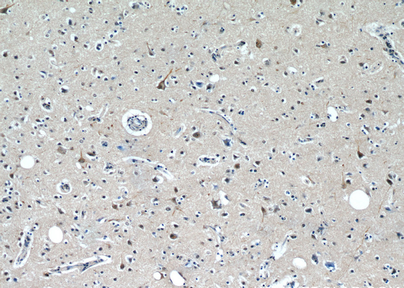 Immunohistochemical of paraffin-embedded human brain using Catalog No:114094(PPP1R9B antibody) at dilution of 1:50 (under 10x lens)