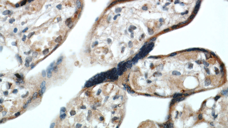 Immunohistochemical of paraffin-embedded human placenta using Catalog No:111045(GOLPH3 antibody) at dilution of 1:100 (under 40x lens)