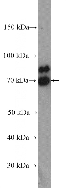 mouse testis tissue were subjected to SDS PAGE followed by western blot with Catalog No:109829(DDX3Y Antibody) at dilution of 1:300