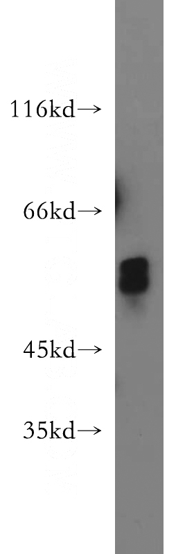 HEK-293 cells were subjected to SDS PAGE followed by western blot with Catalog No:110909(GCM2 antibody) at dilution of 1:500