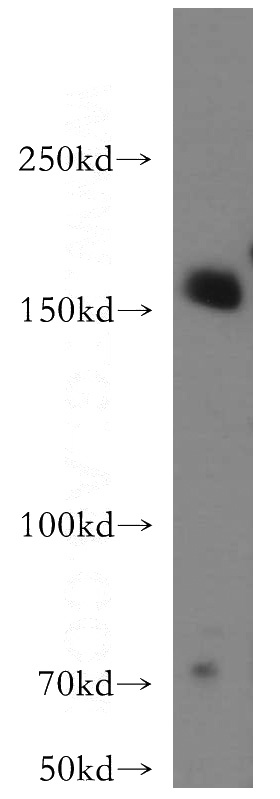 HeLa cells were subjected to SDS PAGE followed by western blot with Catalog No:110300(EDC4 antibody) at dilution of 1:400