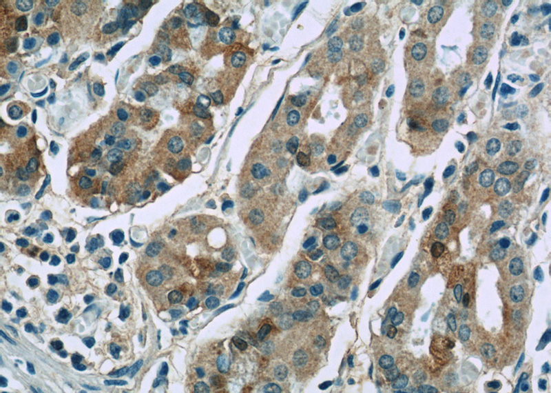 Immunohistochemistry of paraffin-embedded human stomach slide using Catalog No:116712(VANGL2 Antibody) at dilution of 1:50