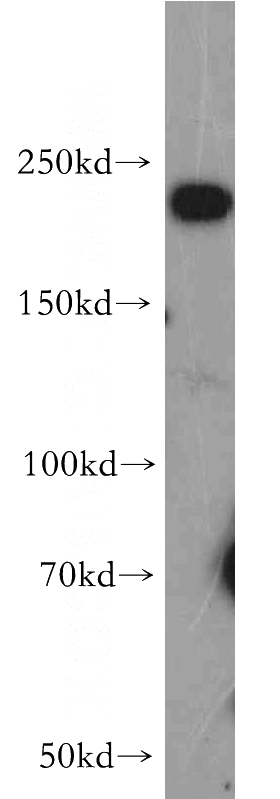 A431 cells were subjected to SDS PAGE followed by western blot with Catalog No:115008(SCN9A-Specific antibody) at dilution of 1:500
