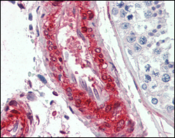 Immunohistochemical analysis of paraffin-embedded human vessels tissues using LPP mouse mAb.