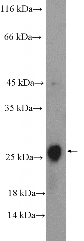 mouse eye tissue were subjected to SDS PAGE followed by western blot with Catalog No:109403(CLRN2 Antibody) at dilution of 1:300