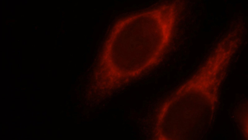 Immunofluorescent analysis of HeLa cells using Catalog No:107172(COXIV Antibody) at dilution of 1:25 and Rhodamine-Goat anti-Mouse IgG