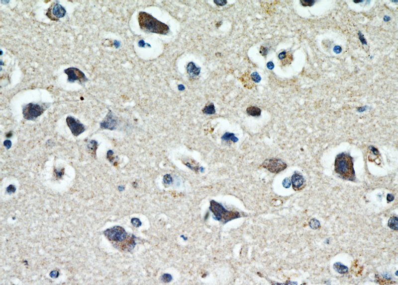 Immunohistochemical of paraffin-embedded human brain using Catalog No:116851(WBSCR17 antibody) at dilution of 1:100 (under 40x lens)