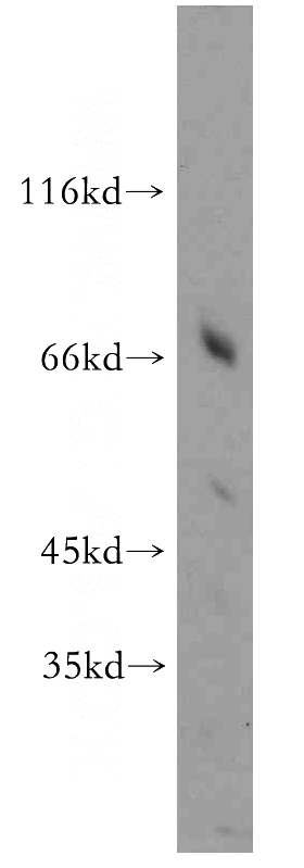 L02 cells were subjected to SDS PAGE followed by western blot with Catalog No:111458(HPSE2 antibody) at dilution of 1:300